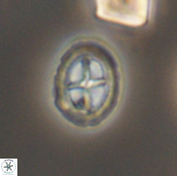 Prediscosphaera spinosa 6467