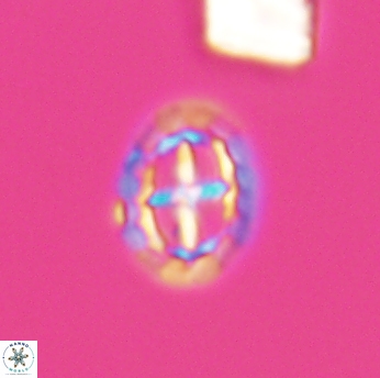 Prediscosphaera spinosa 6460