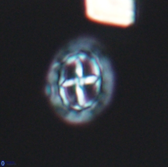Prediscosphaera spinosa 6461