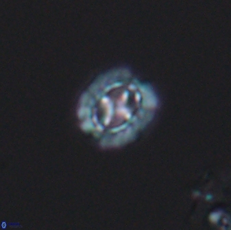 Prediscosphaera spinosa 8798