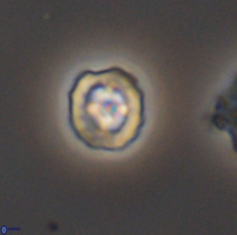 Prediscosphaera spinosa 8800