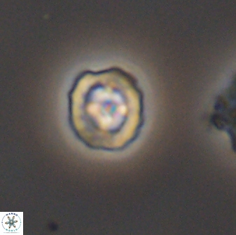 Prediscosphaera spinosa 8800