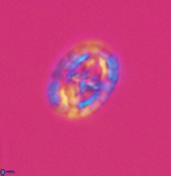 Prediscosphaera spinosa 9686