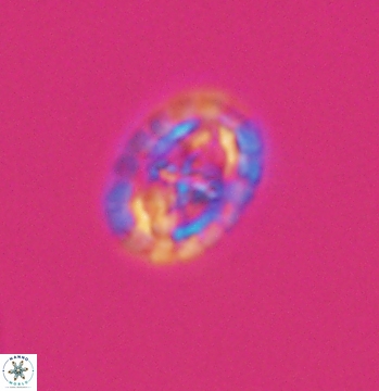 Prediscosphaera spinosa 9686
