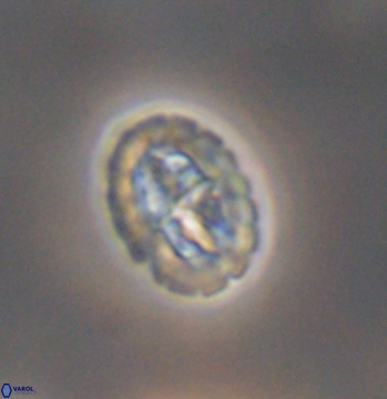 Prediscosphaera spinosa 9687