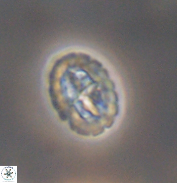 Prediscosphaera spinosa 9687