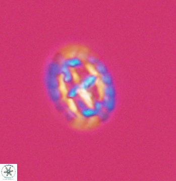 Prediscosphaera spinosa 9682