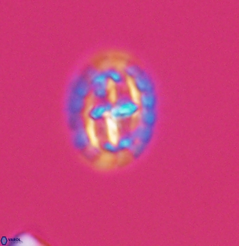 Prediscosphaera spinosa 9683