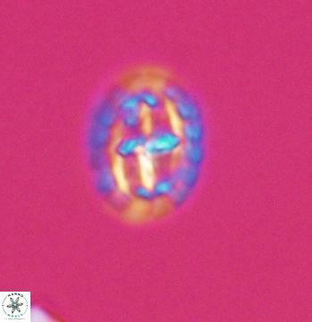 Prediscosphaera spinosa 9683