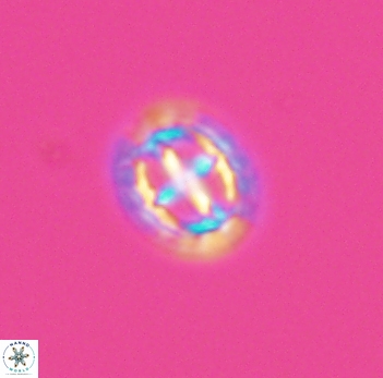 Prediscosphaera spinosa 10194