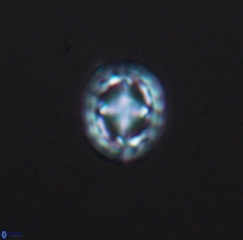 Prediscosphaera spinosa 10196