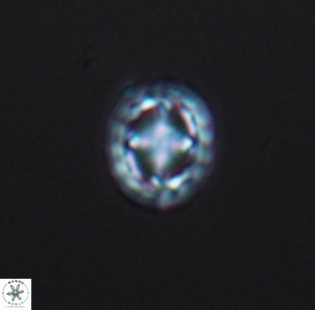 Prediscosphaera spinosa 10196
