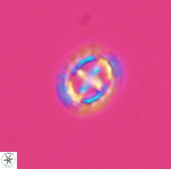 Prediscosphaera spinosa 10199