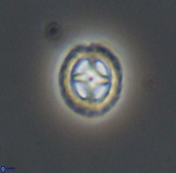 Prediscosphaera spinosa 10200