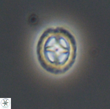 Prediscosphaera spinosa 10200