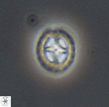 Prediscosphaera spinosa 10202