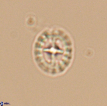 Prediscosphaera spinosa 10203