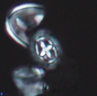 Prediscosphaera spinosa 13643