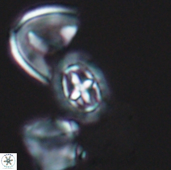 Prediscosphaera spinosa 13643