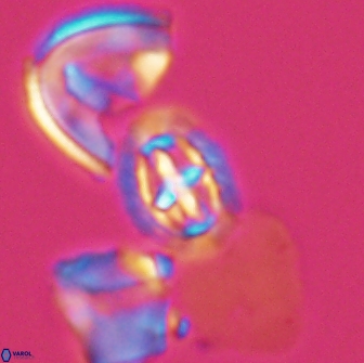 Prediscosphaera spinosa 13644