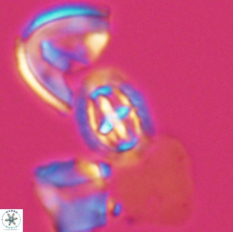 Prediscosphaera spinosa 13644