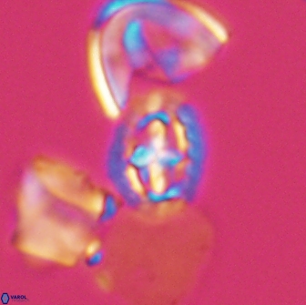 Prediscosphaera spinosa 13645