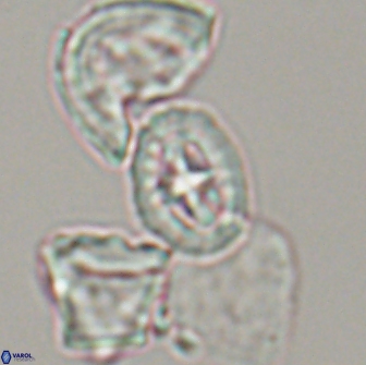 Prediscosphaera spinosa 13649