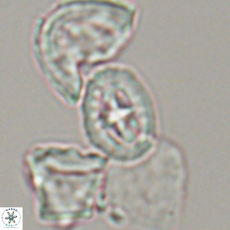 Prediscosphaera spinosa 13649