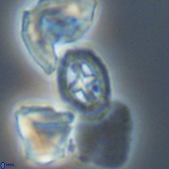 Prediscosphaera spinosa 13650