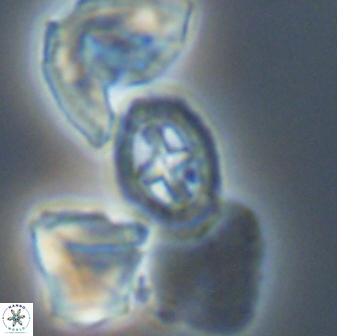 Prediscosphaera spinosa 13650