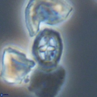 Prediscosphaera spinosa 13651