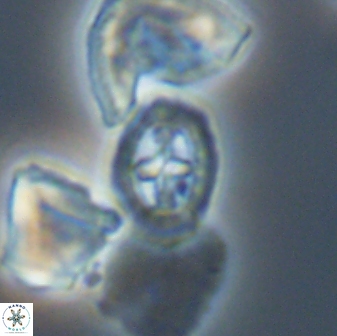 Prediscosphaera spinosa 13651