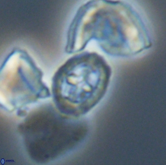Prediscosphaera spinosa 13652