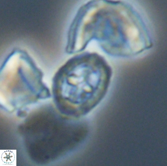Prediscosphaera spinosa 13652