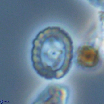 Prediscosphaera spinosa 33440