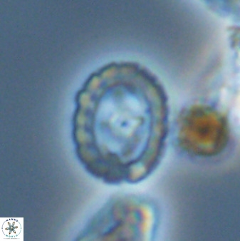 Prediscosphaera spinosa 33440