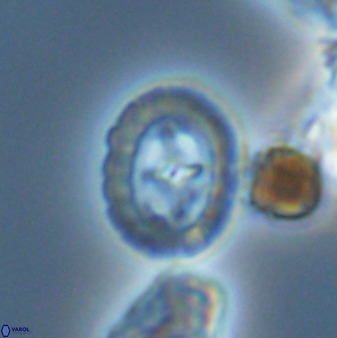 Prediscosphaera spinosa 33441