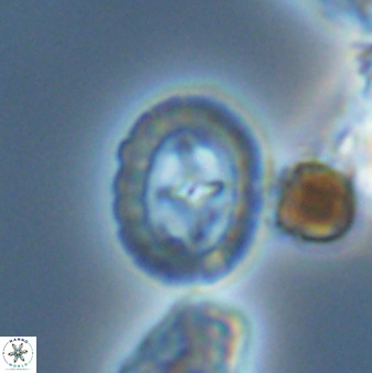 Prediscosphaera spinosa 33441