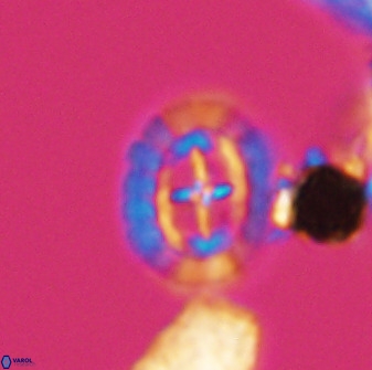 Prediscosphaera spinosa 33427