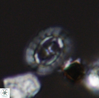 Prediscosphaera spinosa 33431