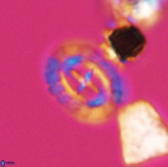 Prediscosphaera spinosa 33433
