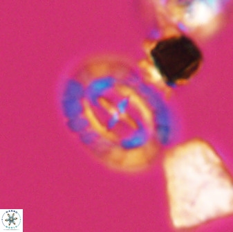 Prediscosphaera spinosa 33433