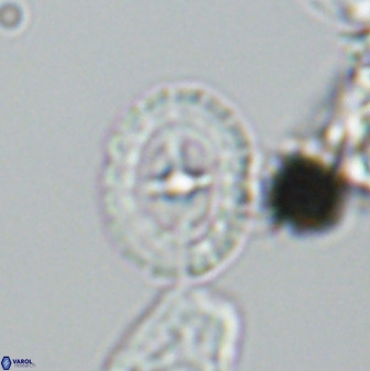 Prediscosphaera spinosa 33435