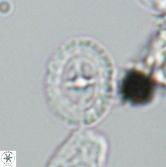 Prediscosphaera spinosa 33435