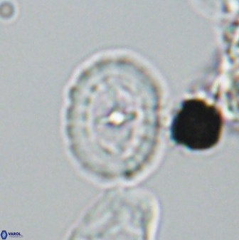 Prediscosphaera spinosa 33436