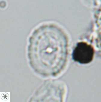 Prediscosphaera spinosa 33436
