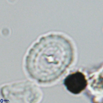 Prediscosphaera spinosa 33437