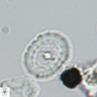 Prediscosphaera spinosa 33437