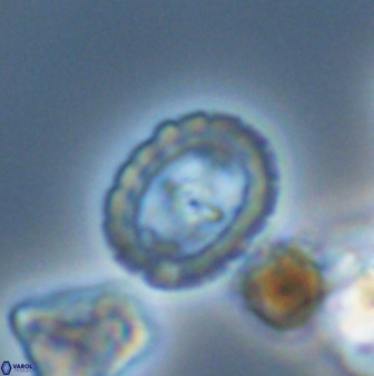Prediscosphaera spinosa 33438
