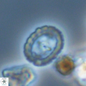 Prediscosphaera spinosa 33438